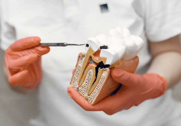 Dental treatment model showing why prompt emergency dental care matters in Louisville KY